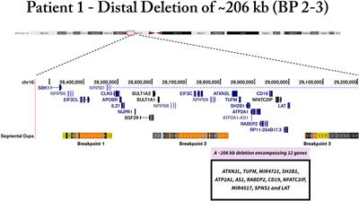 Genomic deletions on 16p11.2 associated with severe obesity in Brazil